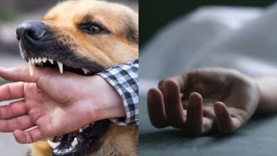 நாய் கடிக்கு ஆளான சிறுவன் 3 மாதங்களுக்கு பிறகு உயிரிழப்பு!