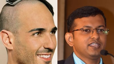 மொட்டை அடித்தால் முடி அடர்த்தியாகுமா? Dr அருண்குமார் விளக்கம்!