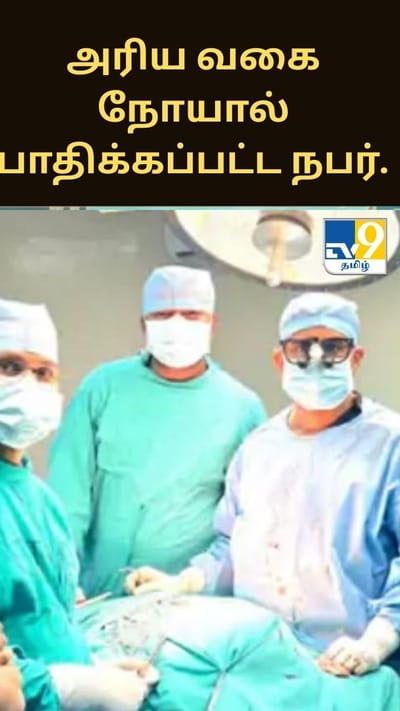 அரிய வகை நோயால் பாதிக்கப்பட்ட நபர்.... 50 சதவிகித வாய்ப்பு - துரிதமாக செயல்பட்டு உயிரைக் காப்பாற்றிய மருத்துவர்கள்