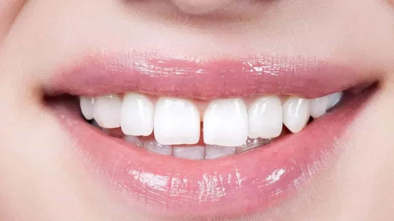 பற்களுக்கு இடையில் இடைவெளி இருப்பது துரதிர்ஷ்டமா? ஜோதிடம் என்ன சொல்கிறது