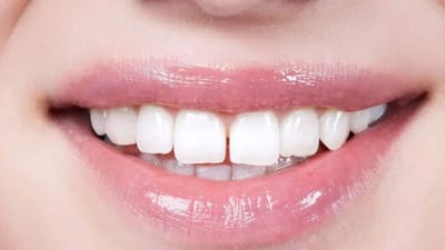 பற்களுக்கு இடையில் இடைவெளி இருப்பது துரதிர்ஷ்டமா?