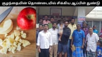 9 மாத குழந்தையின் தொண்டையில் சிக்கிய ஆப்பிள் துண்டு.....