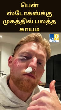 வலை பயிற்சியின்போது விபத்து… இங்கிலாந்து கேப்டன் பென் ஸ்டோக்ஸ்க்கு முகத்தில் பலத்த காயம்...