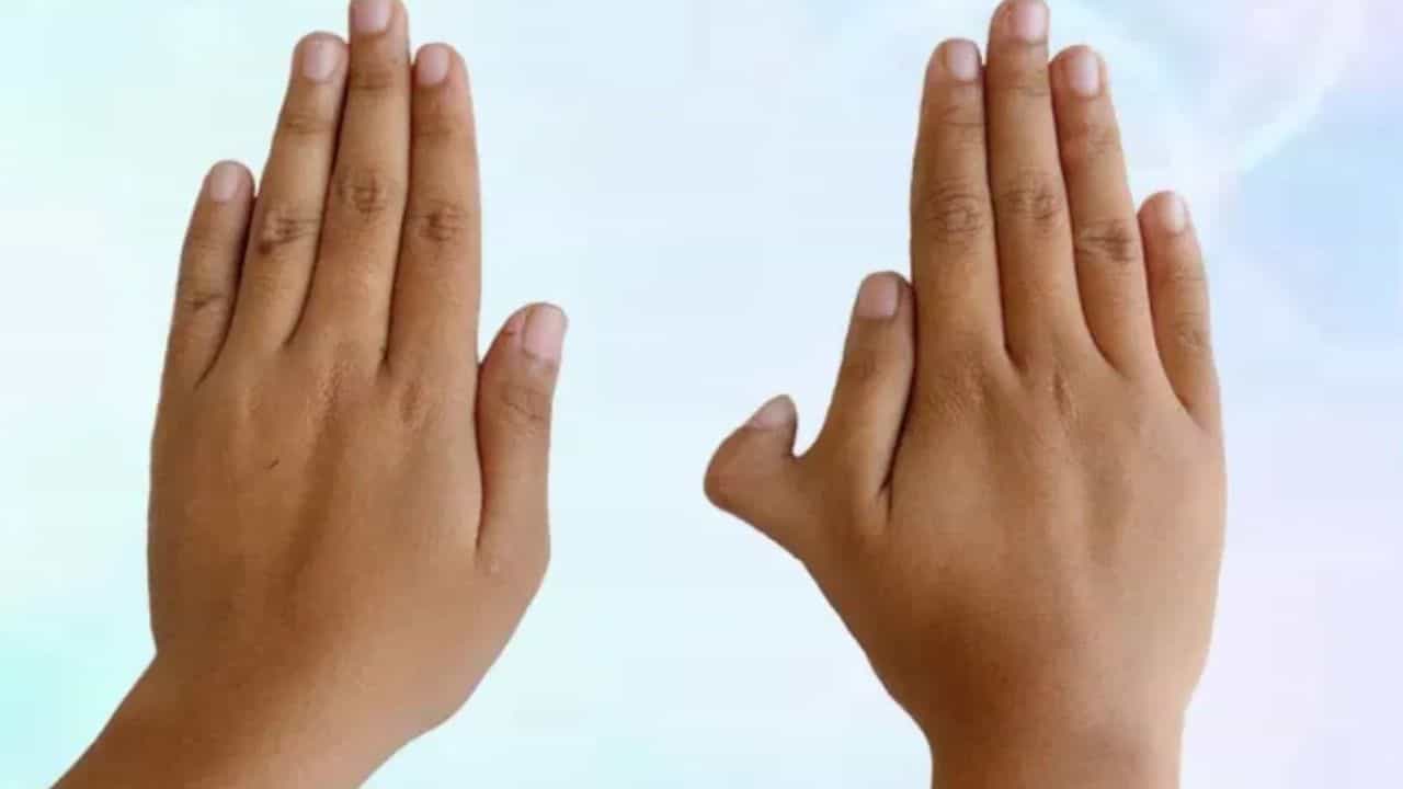 கையில் 6 விரல்கள் இருந்தால் நல்லதா? கெட்டதா? ஆன்மிகம் சொல்வதென்ன?