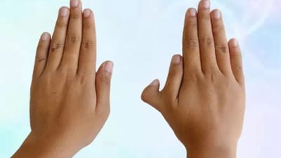 கையில் 6 விரல்கள் இருந்தால் நல்லதா? கெட்டதா? ஆன்மிகம் சொல்வதென்ன?
