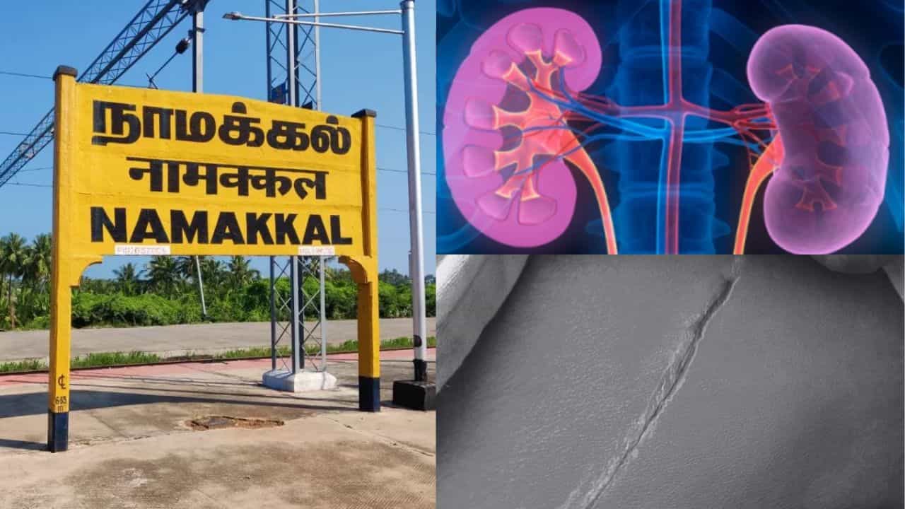 தமிழகத்தை உலுக்கிய கிட்னி திருட்டு விவகாரம்...கொடூர சம்பவத்தில் மறைந்திருக்கும் மக்களின் சோக கதை!