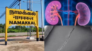 தமிழகத்தை உலுக்கிய கிட்னி திருட்டு விவகாரம்…கொடூர சம்பவத்தில் மறைந்திருக்கும் மக்களின் சோக கதை!