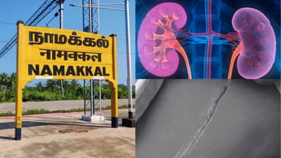 கிட்னி திருட்டு சம்பவத்தில் மறைந்திருக்கும் சோக கதை!