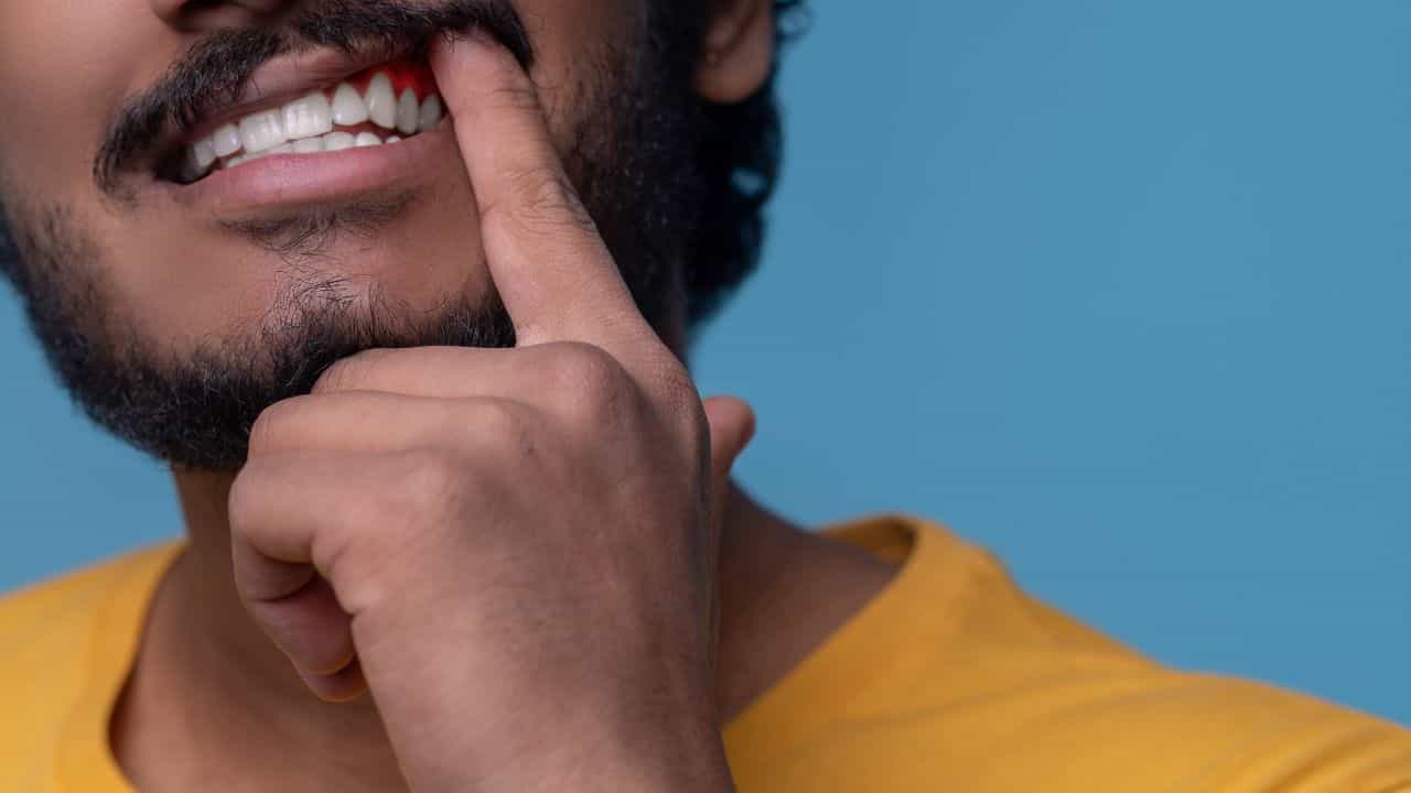 Mouth Care: 2 வாரங்களுக்கு மேல் வாயில் புண்.. வாய்ப் புற்றுநோயின் அறிகுறியா? Mouth Care: 2 வாரங்களுக்கு மேல் வாயில் புண்.. வாய்ப் புற்றுநோயின் அறிகுறியா?