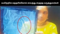 பெண்ணின் வயிற்றில் கத்தரிக்கோல் வைத்து தைத்த மருத்துவர்கள்!...