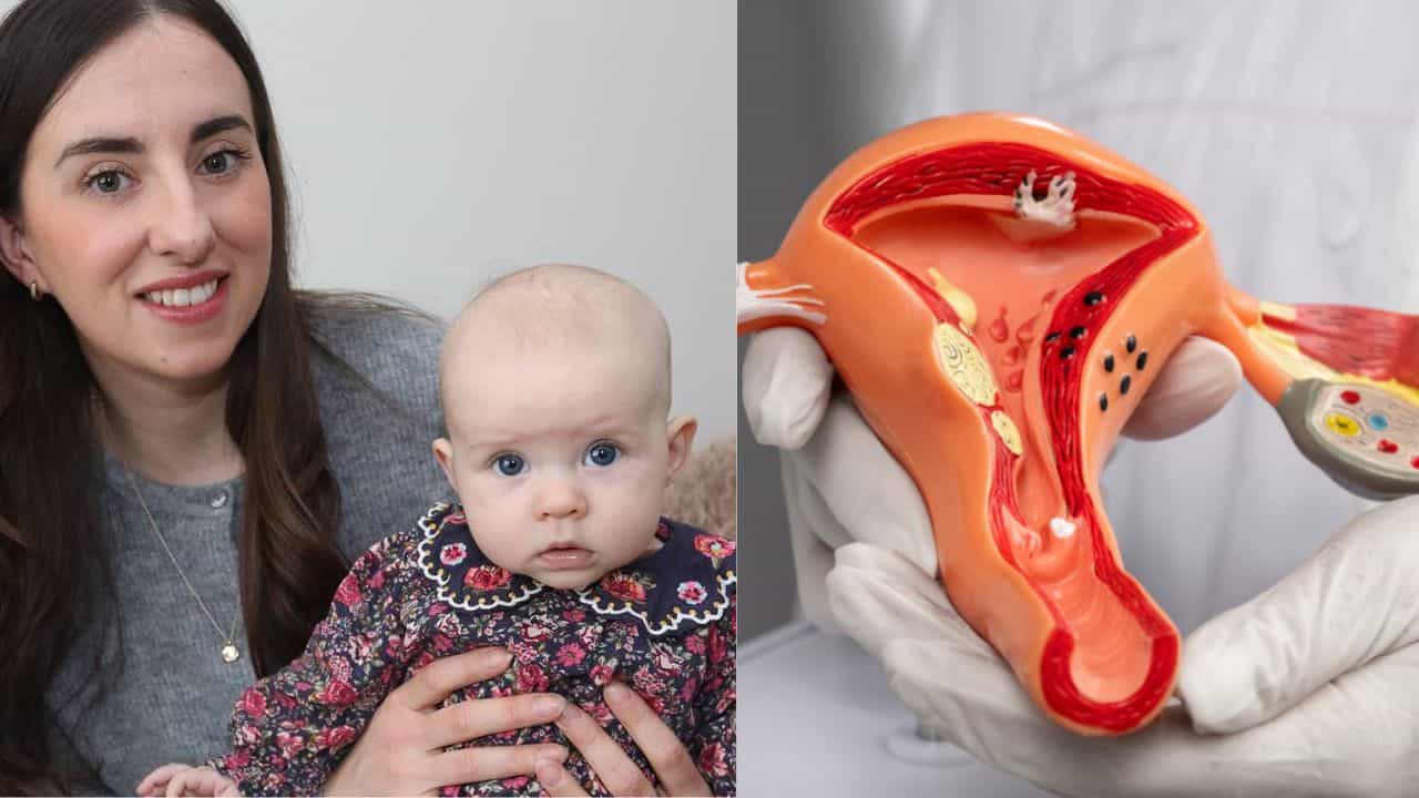 பிசிஓஎஸ் மற்றும் எண்டோமெட்ரியோசிஸை கடந்து குழந்தை பெற்றெடுத்த பெண்..!