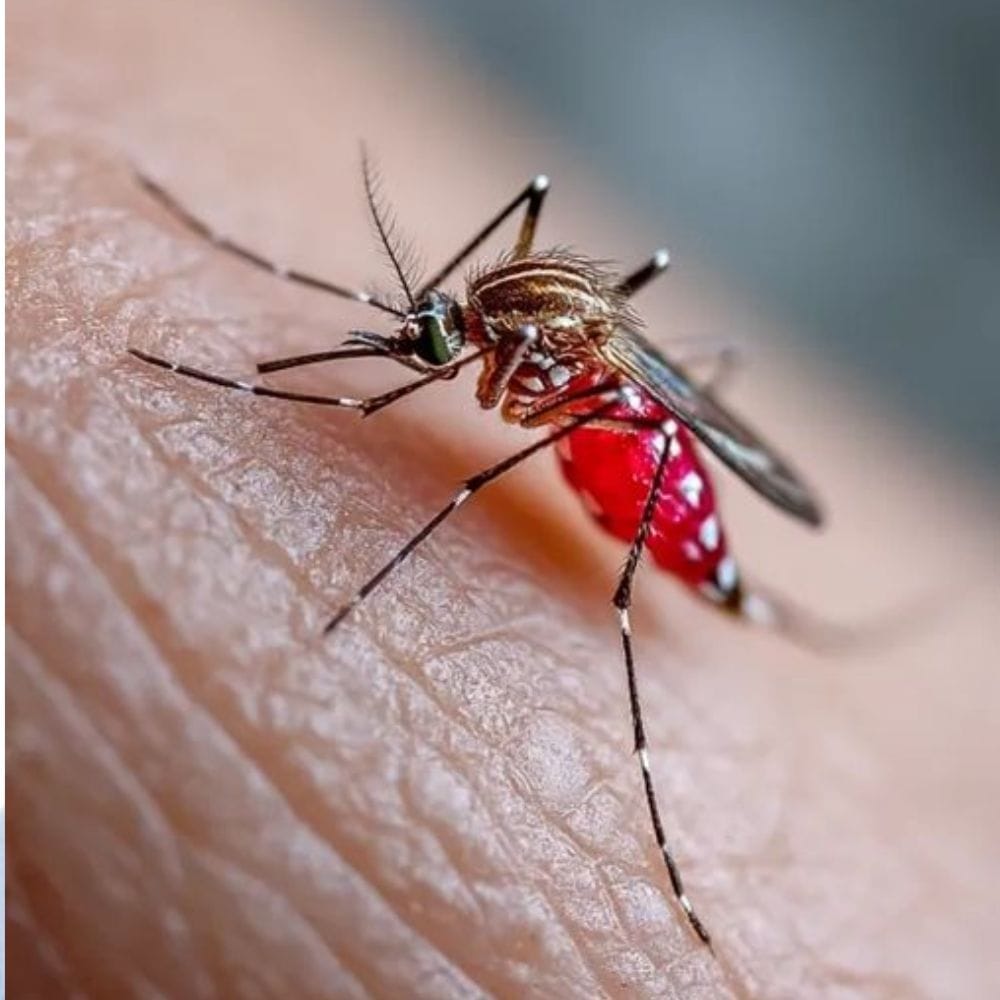 இந்த நோயால் பாதிக்கப்பட்டவர்களில் பலர் தாங்கள் பாதிக்கப்பட்டதை அறியாமல் இருக்கலாம்.
அறிகுறிகள் வந்தால் காய்ச்சல், தலைவலி, உடல் வலி, சோர்வு மற்றும் தோல் சிரங்கு போன்றவை இருக்கும்.
சில நேரங்களில் இவை சாதாரண காய்ச்சலாகவே தோன்றலாம். அதனால் கவனமாக அறிகுறிகளை கவனிப்பது மிகவும் முக்கியம்.