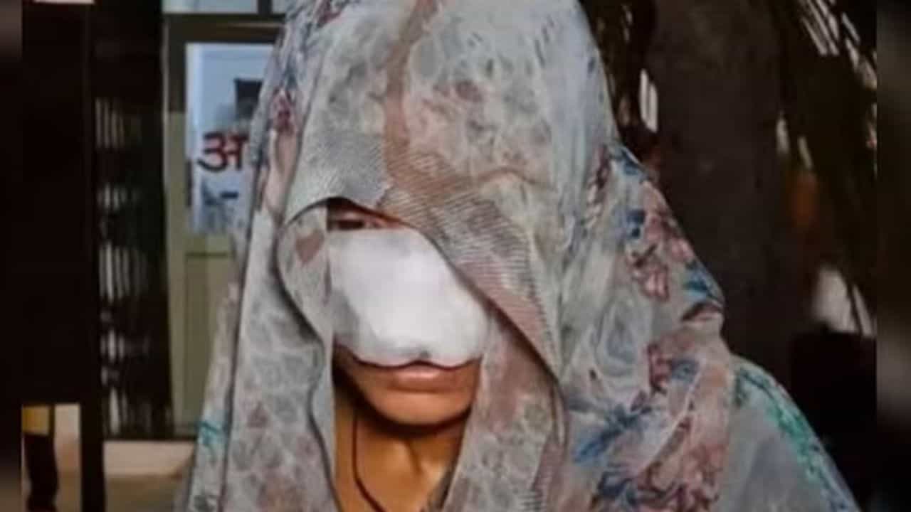 குடும்ப தகராறு.. உபியில் மனைவியின் மூக்கை கடித்து துப்பிய கணவன்!