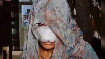 உபியில் மனைவியின் மூக்கை கடித்து துப்பிய கணவன்!