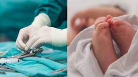 பிறந்த குழந்தைக்கு இதய அறுவை சிகிச்சை.. டெல்லியில் மருத்துவர்கள் சாதனை!...