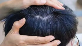 Hair Care: இளம் வயதில் நரை முடி பிரச்சனையா..? சரிசெய்யும் 4 உணவு பொருட்கள்..!...