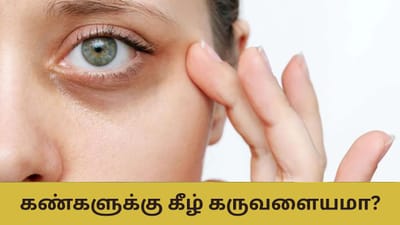 கண்களுக்கு கீழ் கருவளையங்களா..? சரி செய்வது எப்படி..?