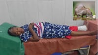 திருச்சி GH-ல் அதிர்ச்சி.. மூதாட்டியின் கால் விரலை கடித்த எலி!...
