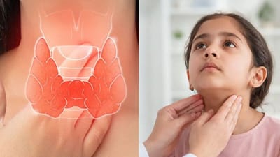 குழந்தைகளை தாக்கும் தைராய்டு.. அறிகுறிகள் இவைதான்!