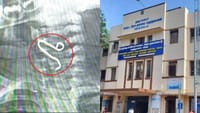 ஒரு வயது குழந்தையின் தொண்டையில் சிக்கிய இரும்பு கம்பி..!...