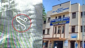 1 வயது குழந்தையின் தொண்டையில் சிக்கிய இரும்பு கம்பி.. அரசு மருத்துவர்கள் செய்த நுட்பமான ஆபரேசன்.. ஈரோட்டில் அதிர்ச்சி சம்பவம்!...