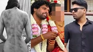 வரதட்சனை கேட்டு மாமனார்-மாமியார் தொந்தரவு.. ஆபாச படமெடுத்து கணவர் மிரட்டல்.. கொடூர தாக்குதலில் பாதிக்கப்பட்ட இளம்பெண்! வரதட்சனை கேட்டு மாமனார்-மாமியார் தொந்தரவு.. ஆபாச படமெடுத்து கணவர் மிரட்டல்.. கொடூர தாக்குதலில் பாதிக்கப்பட்ட இளம்பெண்!