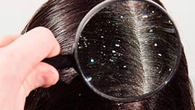 பொடுகு தொல்லைக்கு குட்பை சொல்லும் வெந்தயம் தயிர் ஹேர் பேக்...